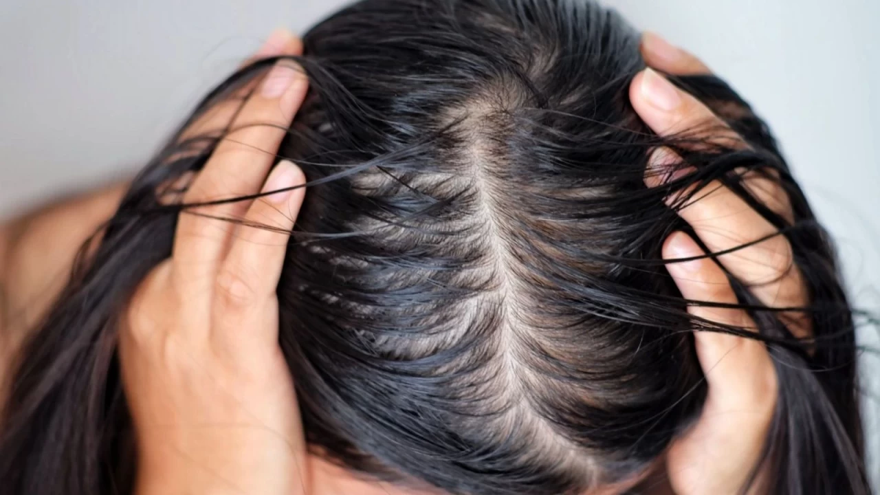 Saçları yağlananlara pratik çözüm!