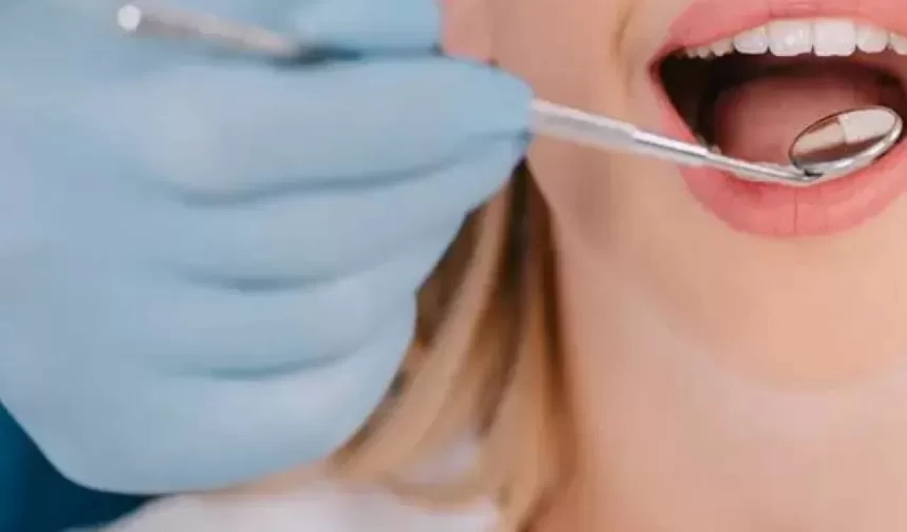 Damak yarasına iyi gelen 6 doğal çözüm