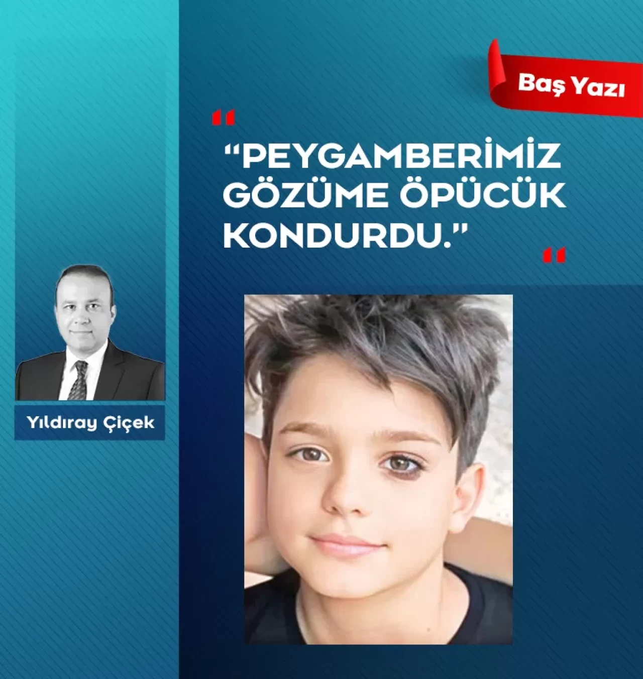 “Peygamberimiz gözüme öpücük kondurdu.”