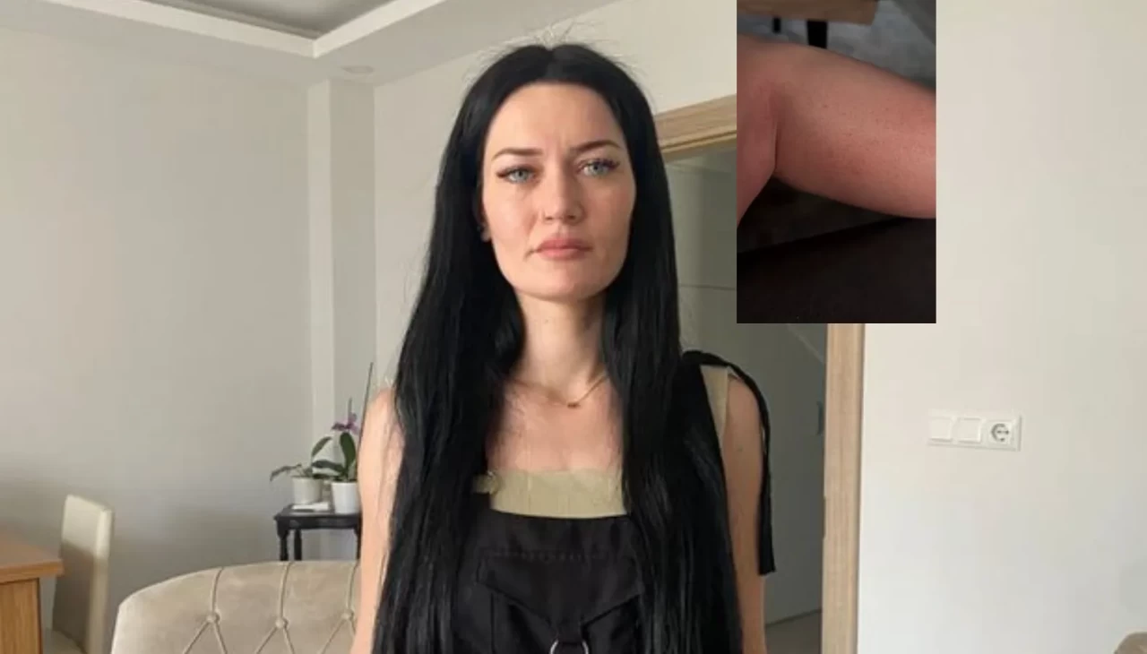 Kocaeli'de solaryumda mahsur kaldı, yanıklar oluştu... yargıdan ceza çıktı!