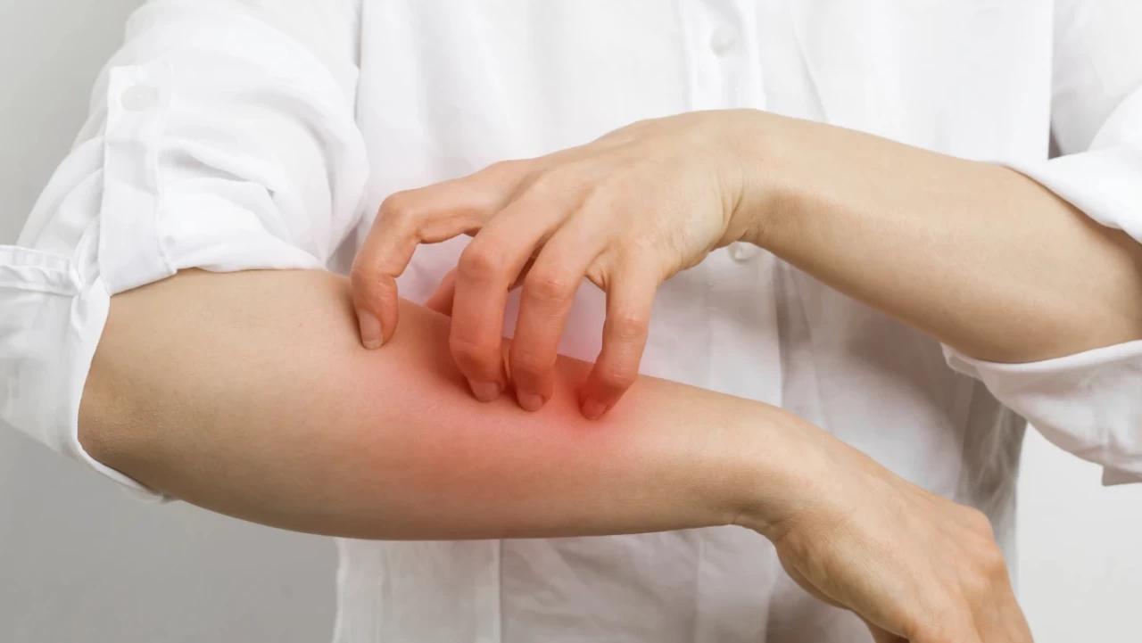 Bayram sofrasında gizli tehlike: Kırmızı et alerjisi can yakabilir