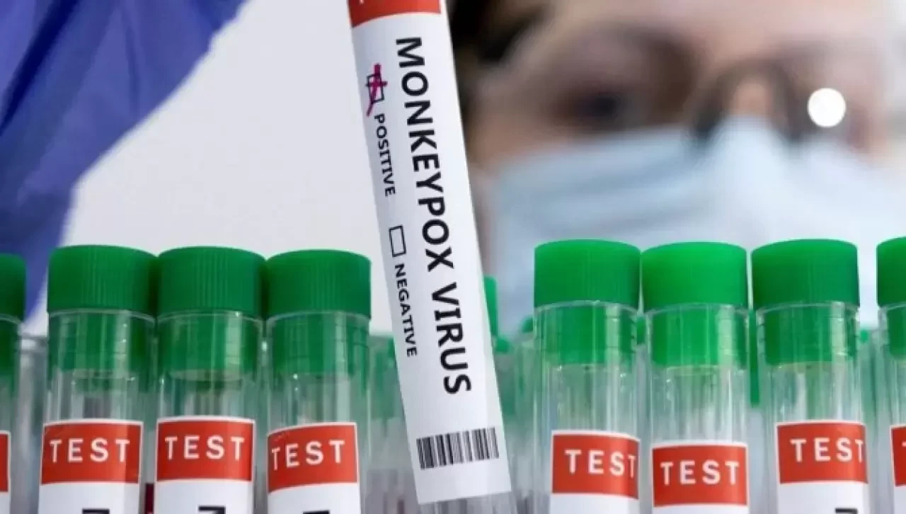 Liberya'da M çiçeği vaka sayısı 78'e yükseldi