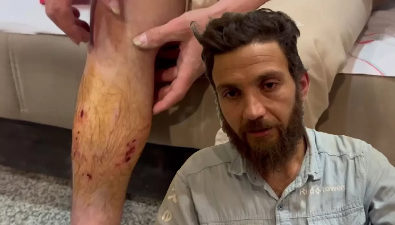 Sahipli köpeğin saldırısına uğrayan adam yaralandı