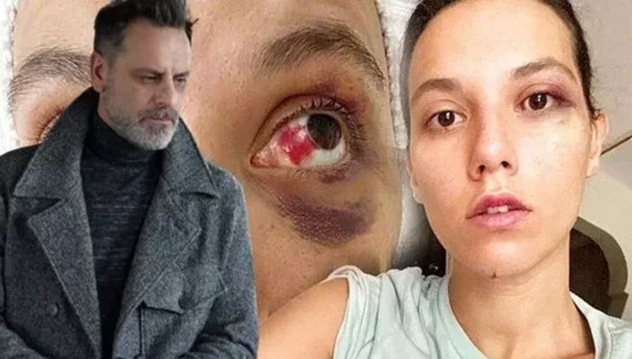 Ozan Güven'e hapis cezası