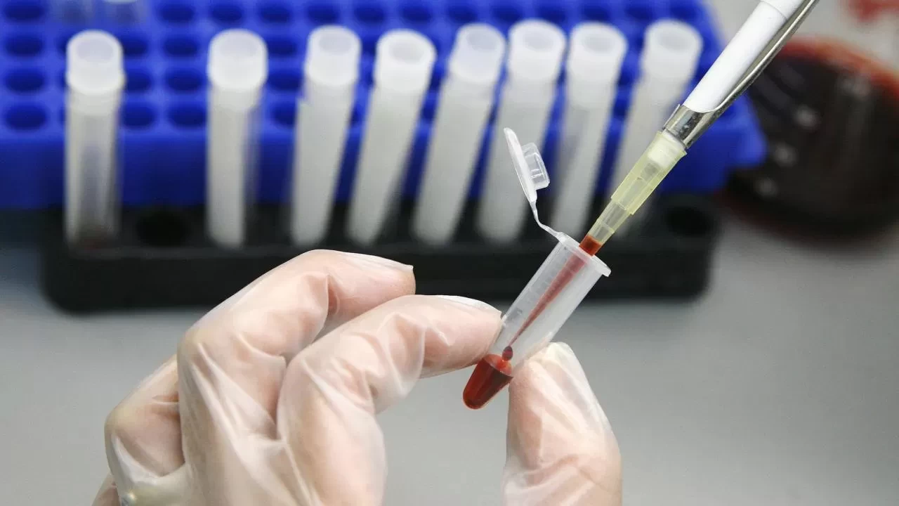 HIV tedavisinde tarihi adım: Virüs hücre içinde görünür hâle getirildi