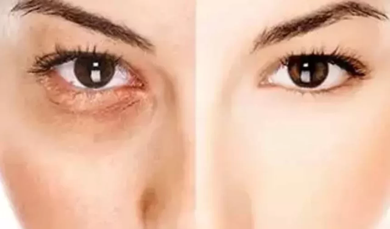 Yaşlanmaya meydan okuyan gençlik sırları