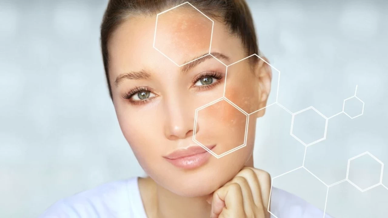 Limon ile gelen güzellik! Yepyeni bir cilt için maske tarifi