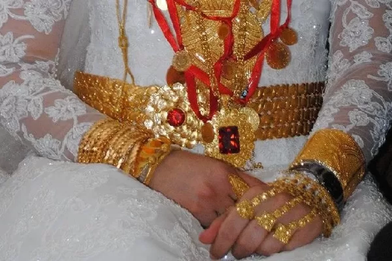 Yüz Görümlüğü Nedir?