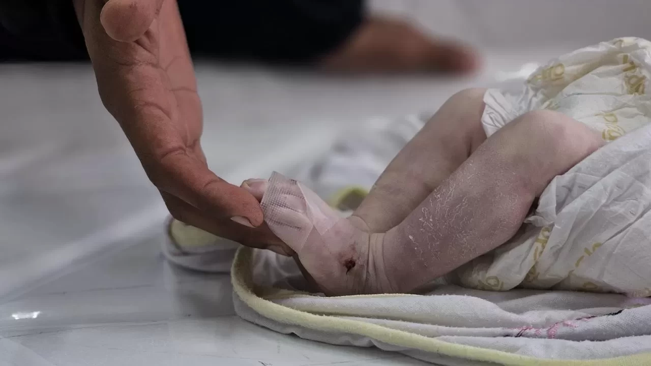 Gazze'de zulüm bitmiyor! Bir bebek daha açlıktan can verdi