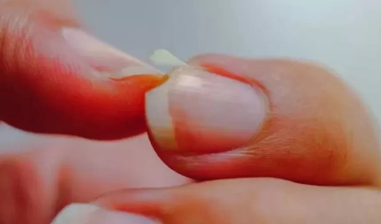 Tırnaklarınız sürekli kırılıyorsa dikkat! İşte kurtarıcı bakım tüyoları