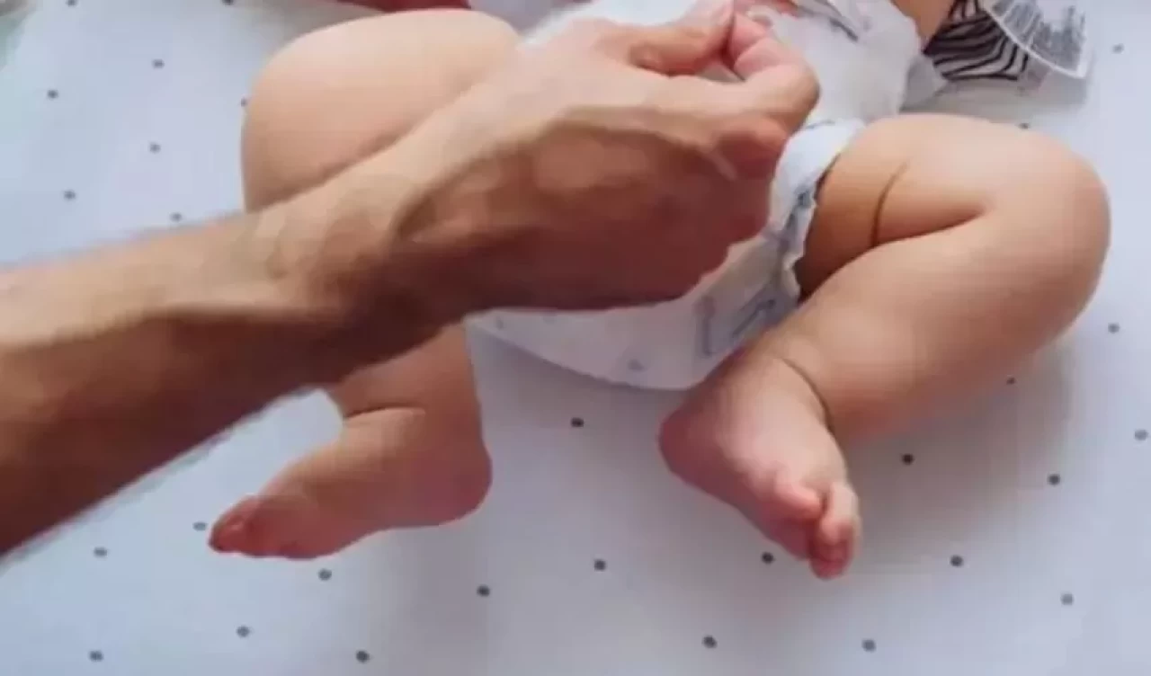 Pişik kabusu bitiyor! Bebek cildini korumanın 5 altın kuralı