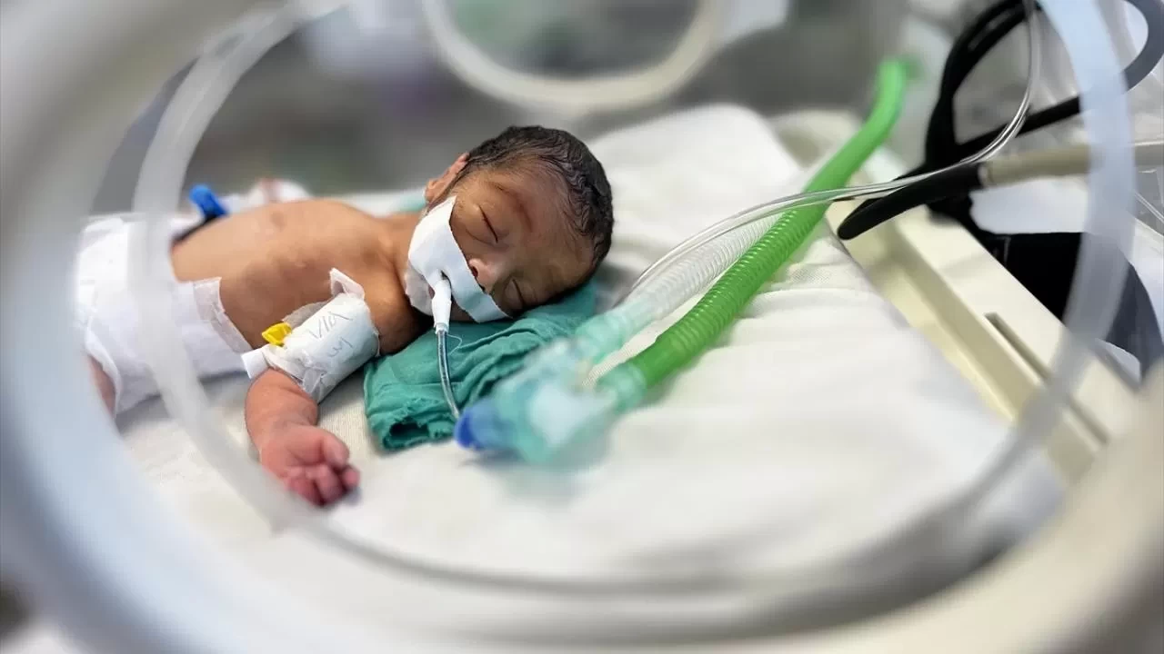 Gazze’de açlık yine can aldı! Biri bebek 2 çocuk hayatını kaybetti