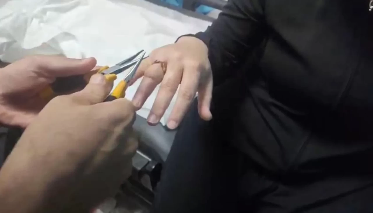 Kadının parmağına sıkışan yüzük, itfaiye ekibince hastanede çıkarıldı