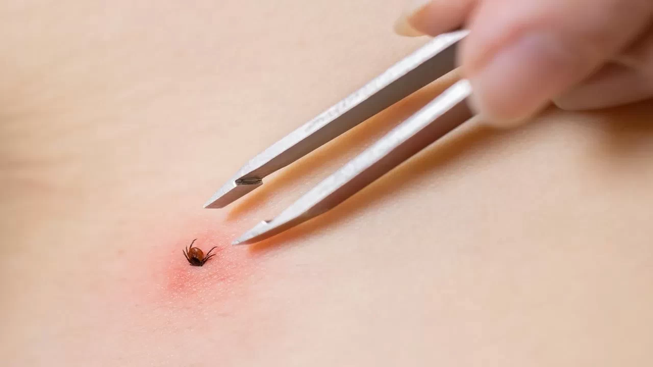 Kene tehlikesine karşı uyarı! Uzmanlar: KKKA erken müdahaleyle önlenebilir