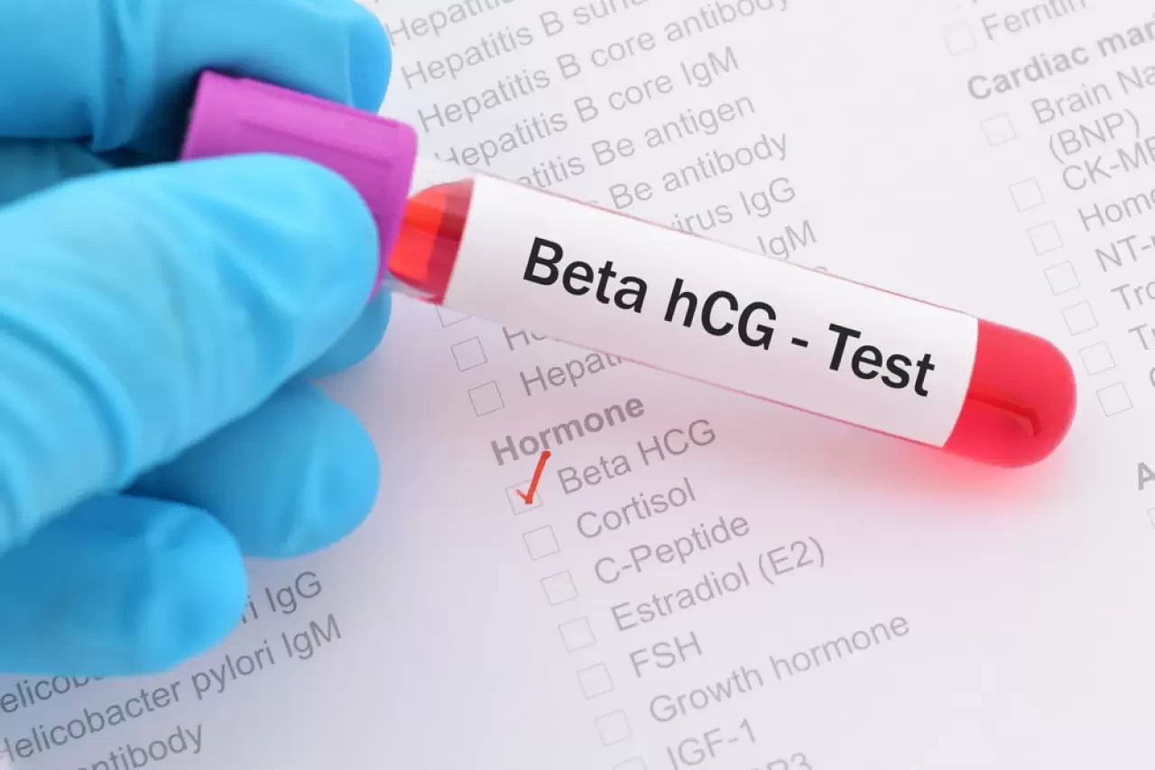Beta HCG nedir?