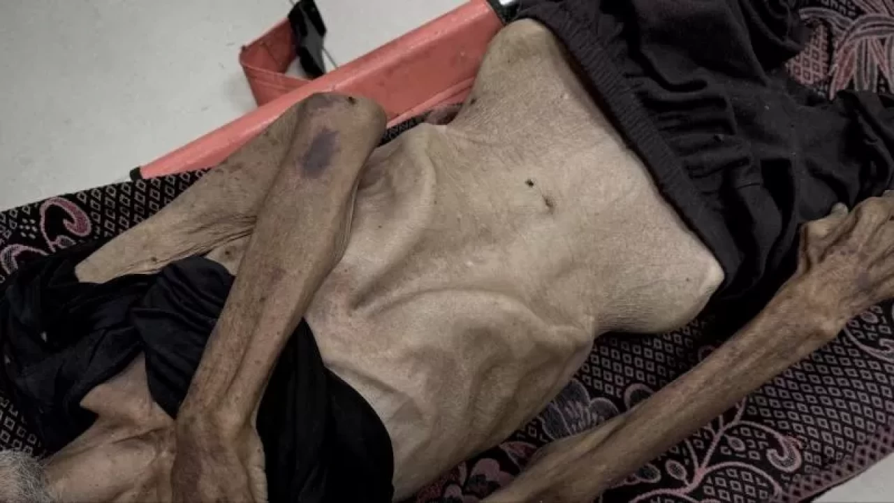 Gazze’de açlık can almaya devam ediyor! Son 24 saatte 5 kişi daha yaşamını yitirdi