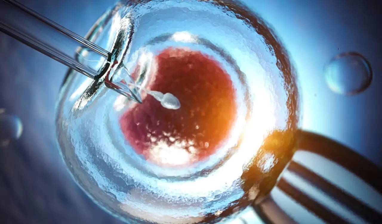 Tüp bebek süreci: Yumurta toplama (OPU) nedir?