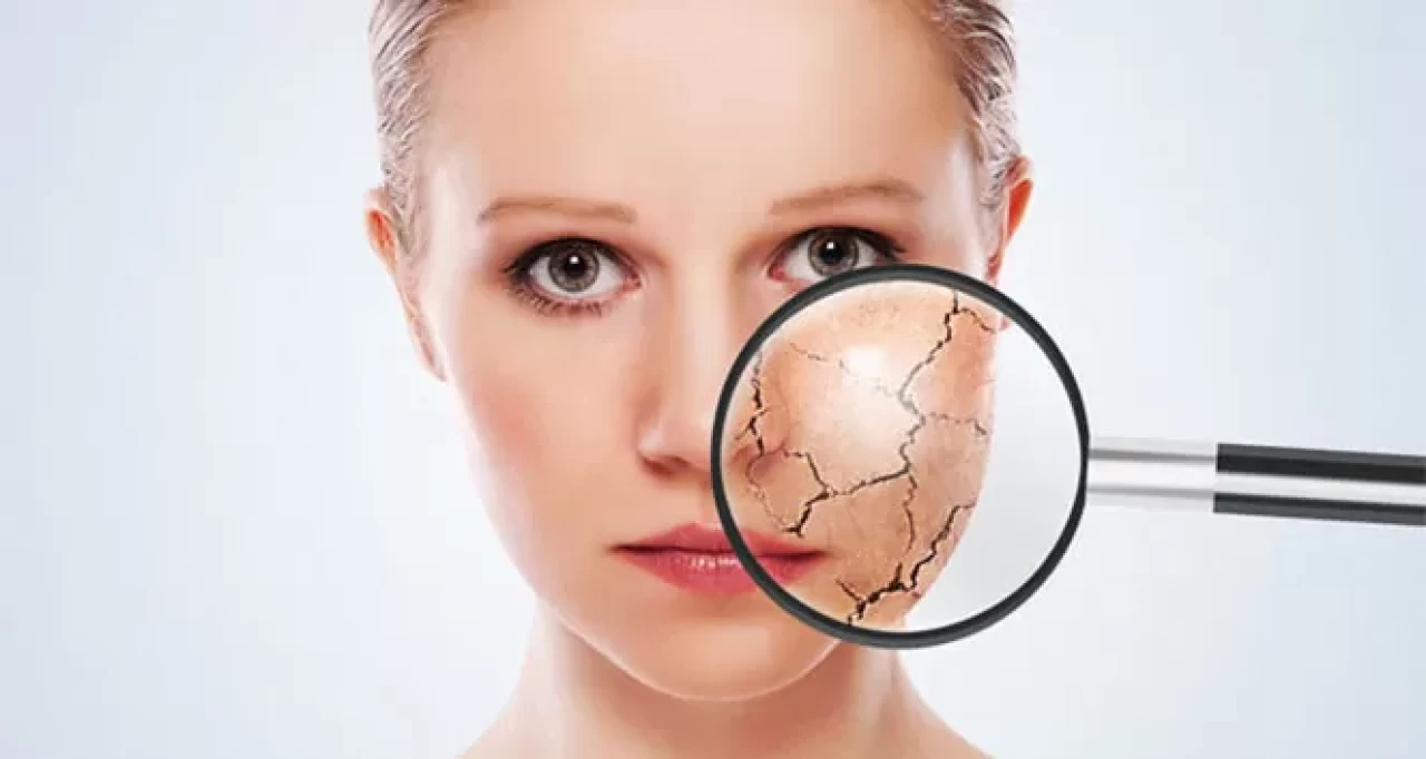 Hangi cilt tipine sahipsiniz? Kolay cilt analizi