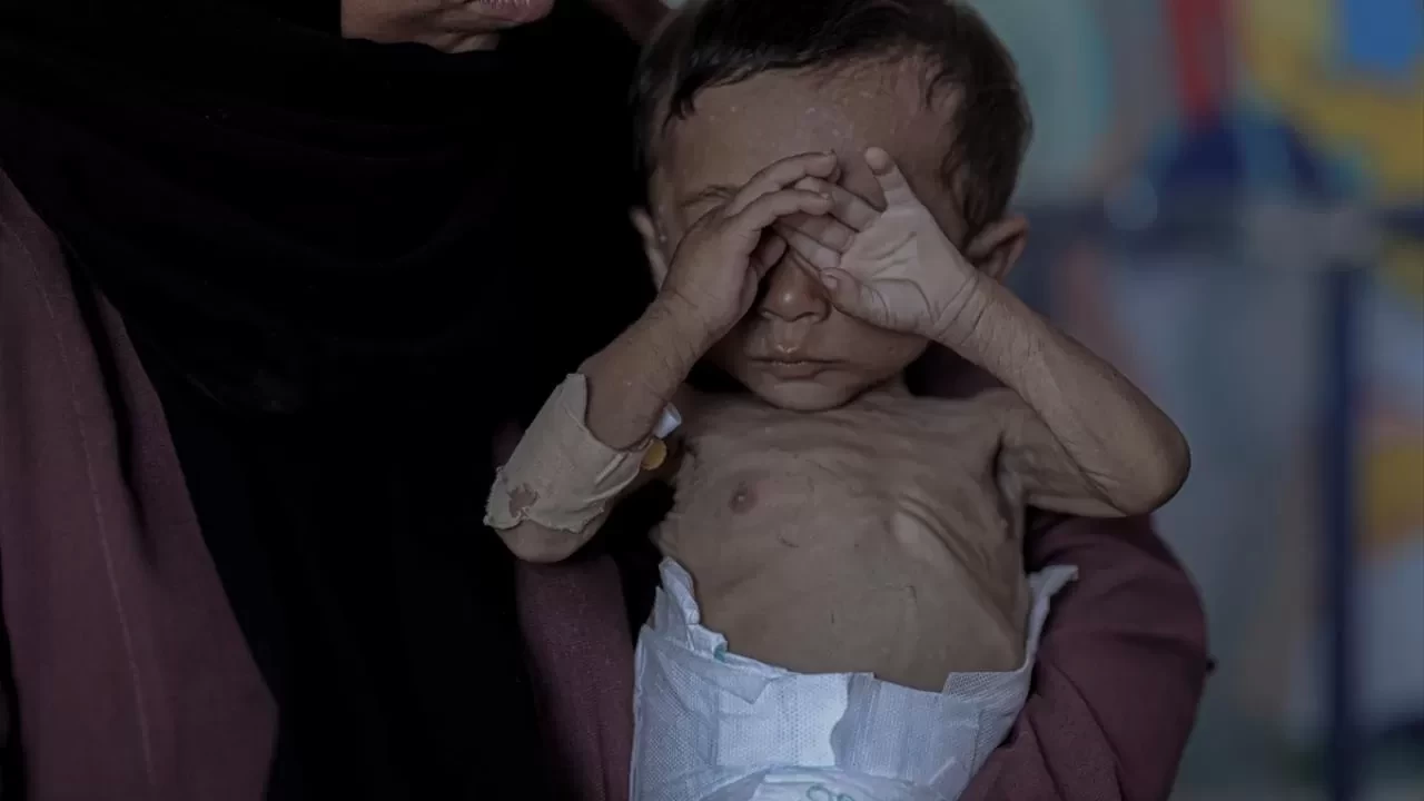 İsrail'in kıtlığı dayattığı Gazze’de açlıktan ölenlerin sayısı 263’e yükseldi