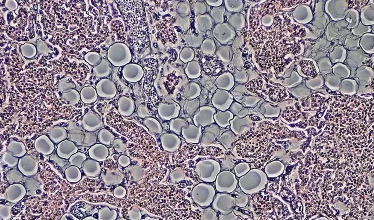 Laboratuvarda ilk canlı insan derisi geliştirildi