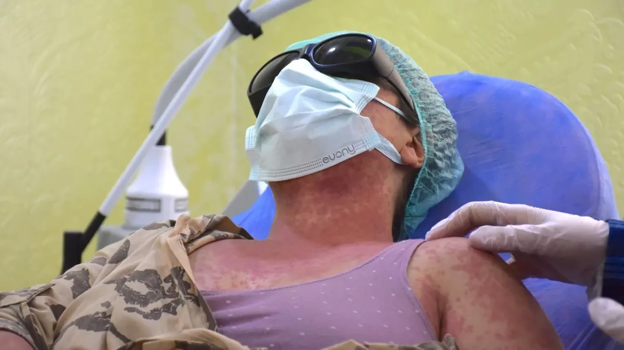 Şikayetler artınca, alarma geçildi! Güzelleşmek isterken hastanelik oldular