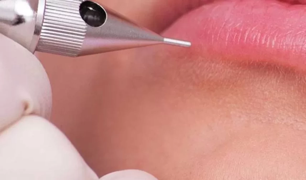 Yüz hatlarını belirginleştiriyor, kalıcı güzellik sağlıyor