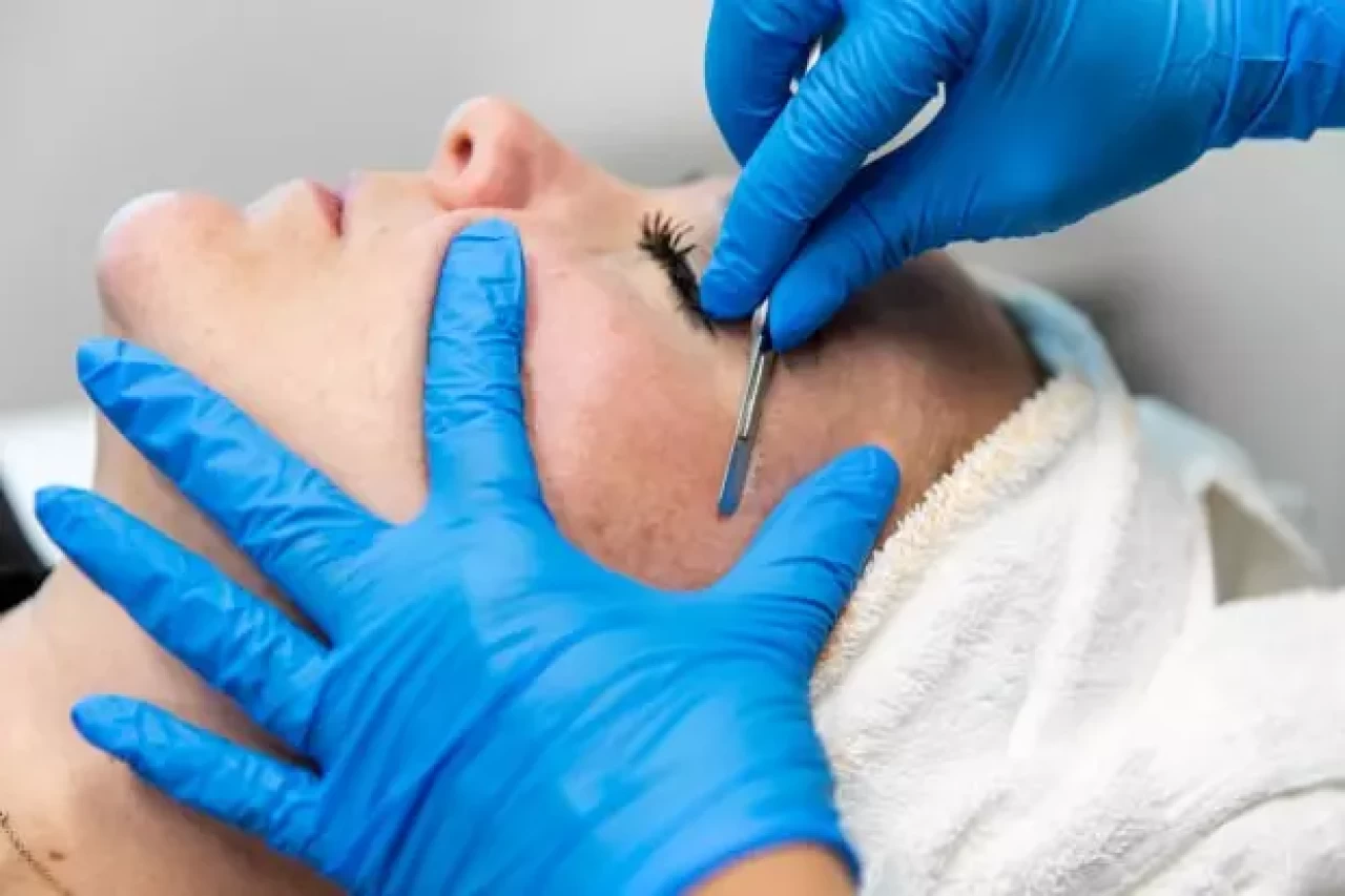 Dermaplaning nedir?