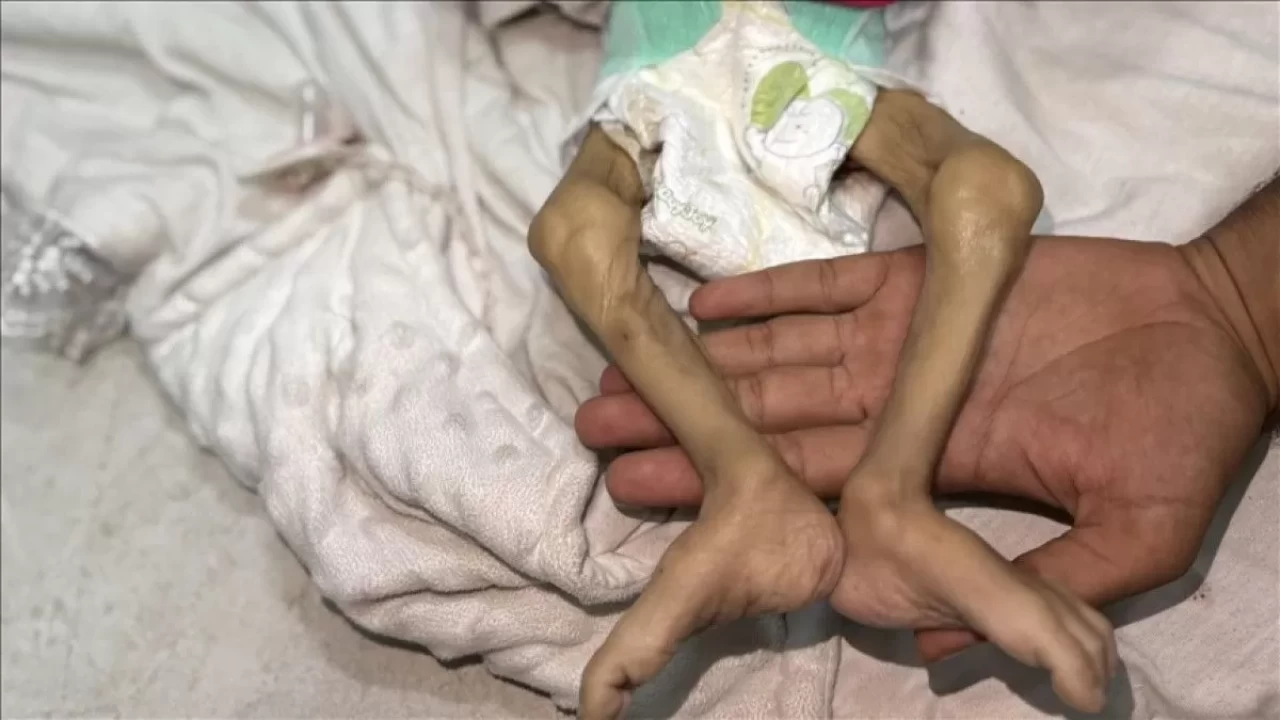 Gazze'de kıtlık ilan edildi