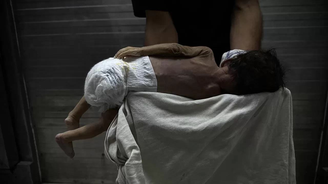 Gazze açlıktan ölüyor! 453 kişi daha hayatını kaybetti