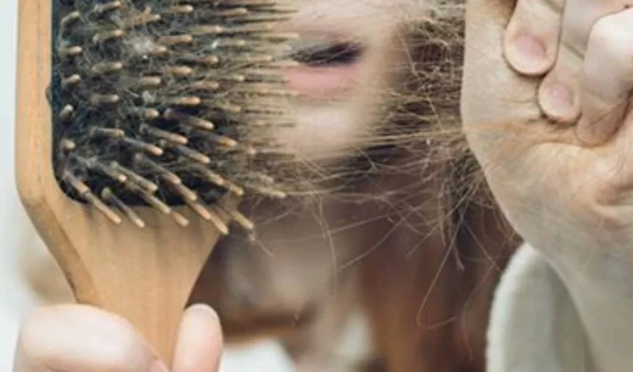 Yanlış beslenme ve stres gençlerde saç dökülmesini tetikliyor