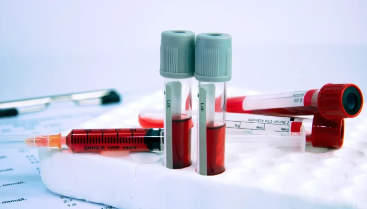 Kilo kaybınız durduysa kan testiyle cevabı bulun