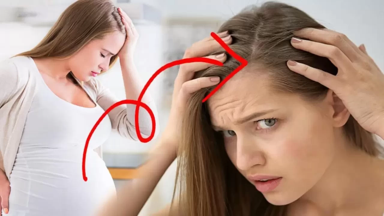 Hamilelikte Saç Dökülmesi Neden Olur, Ne Yapılmalı?