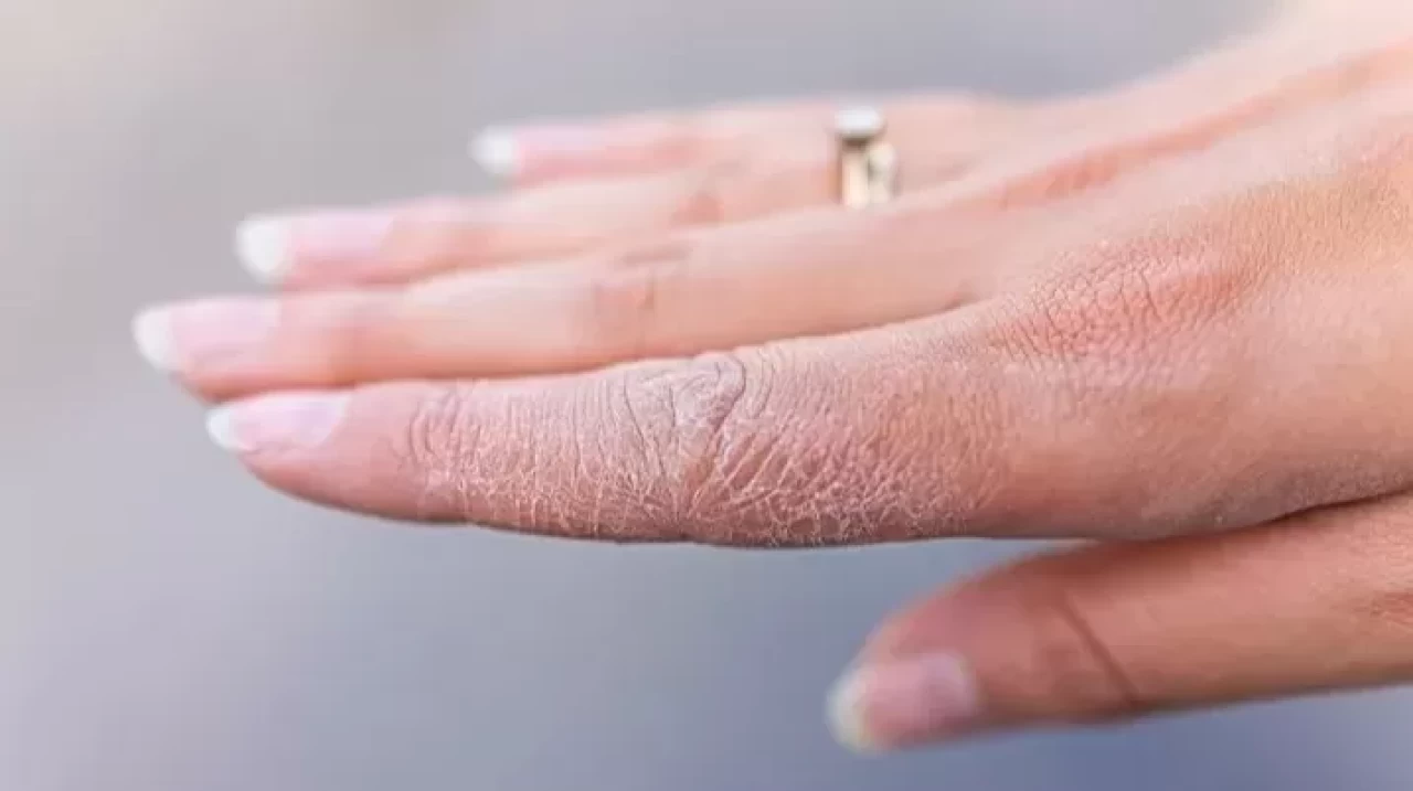 Kurumuş eller için mucize çözüm: 20 dakikada pamuk etkisi