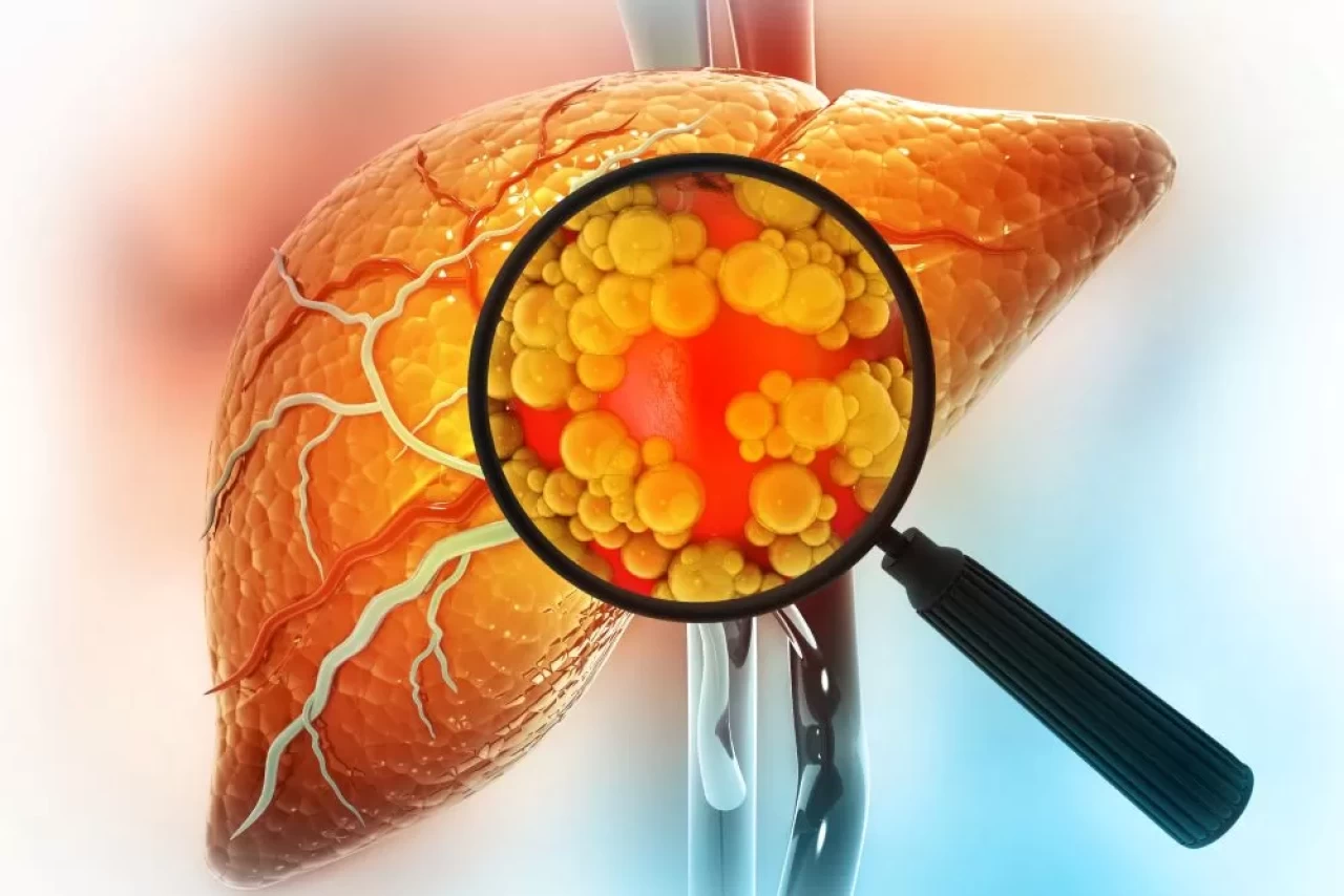 Karaciğerinizi yenilemenin en doğal yolu ortaya çıktı! Doktorların dikkatini çeken kür