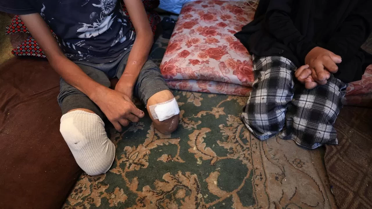 7 Ekim'den bu yana Gazze'de 4 bin çocuk ampute edildi