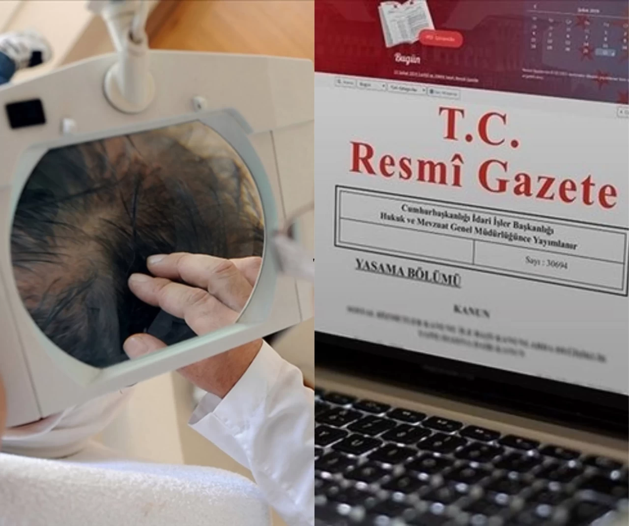 Saç Ekimi Birimleri'nde yeni dönem: Yönetmelik değişikliği Resmi Gazete’de