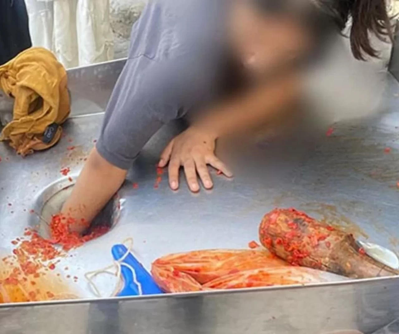 Şanlıurfa’da feci olay! Salça makinesine elini kaptırmıştı