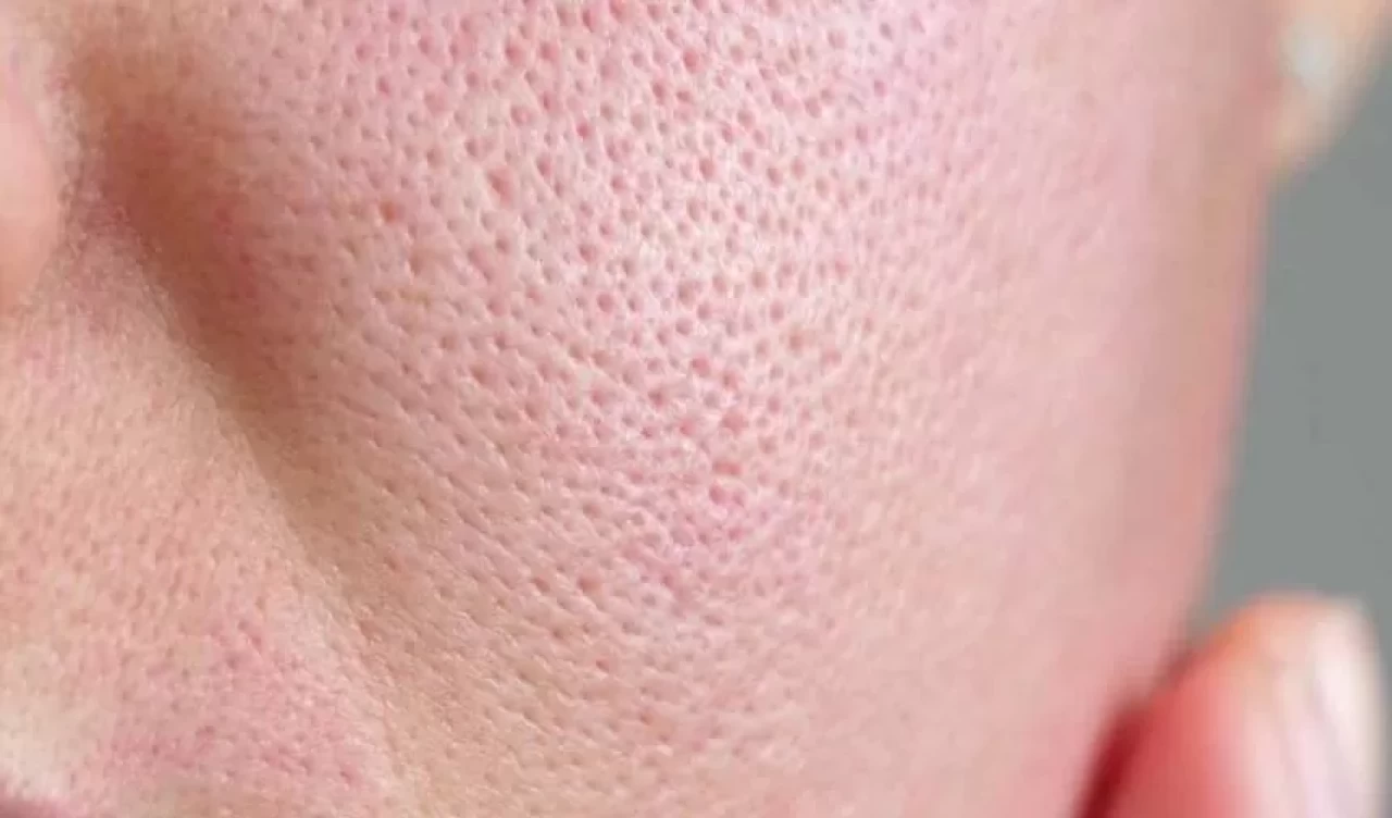 Ciltteki gözenekleri küçültmek için tüketmeniz gereken 4 besin