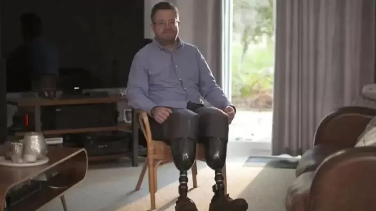 Kendi bacaklarını kesmişti! Dolandırıcılıktan hapse atıldı