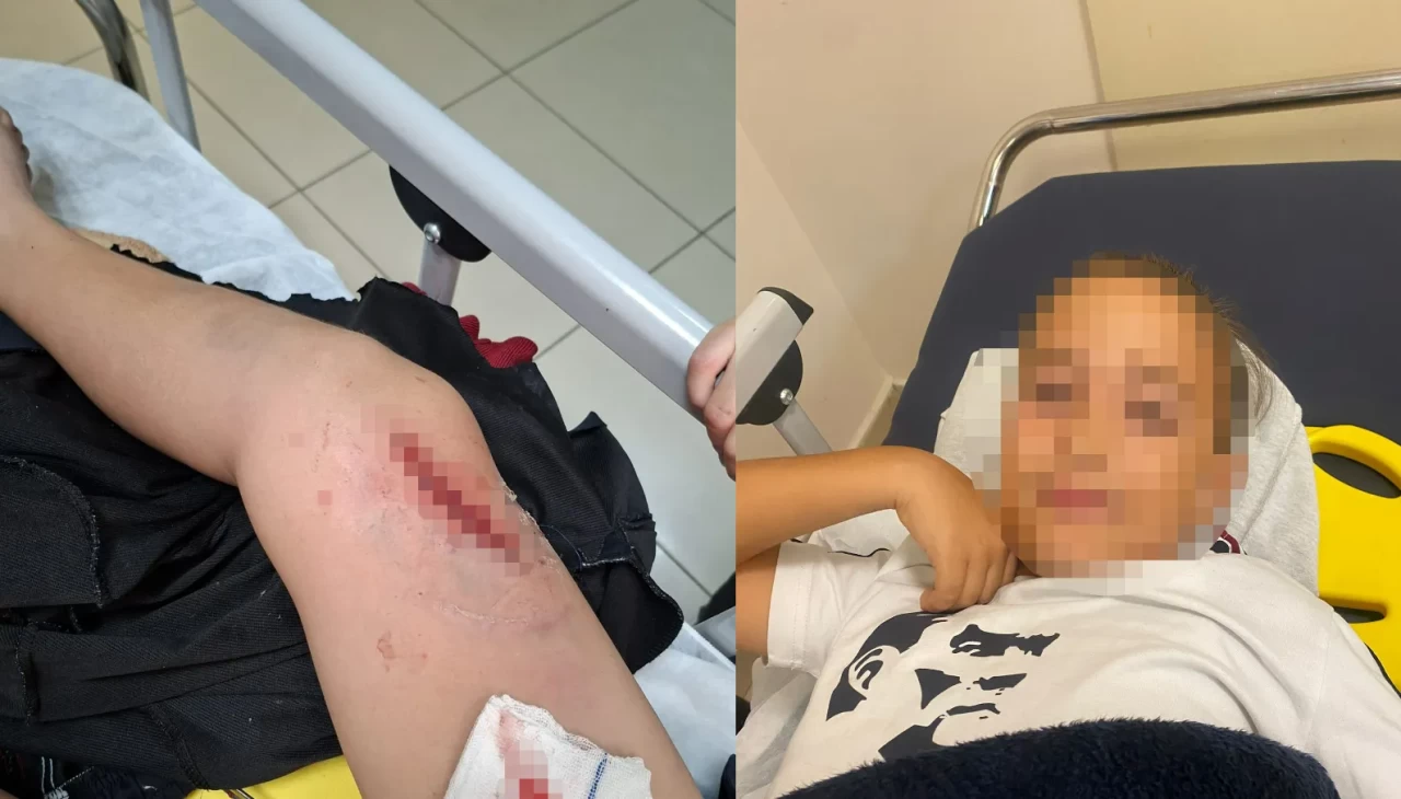 Okul bahçesinde bayrak direği öğrencilerin üzerine devrildi: 1 çocuk yaralandı