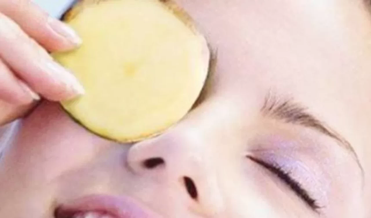 Göz altı morluklarına patates terapisi