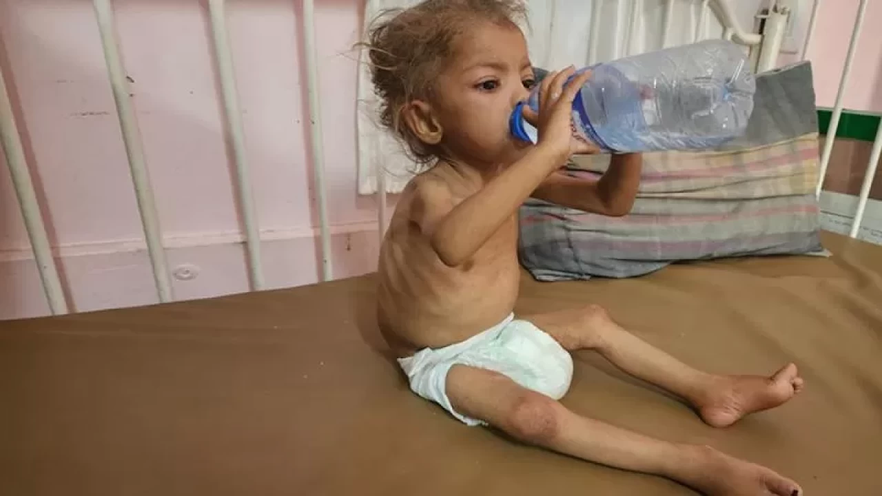 Gazze'de açlıktan ölüyor! Son 24 saatte 3 kişi daha hayatını kaybetti