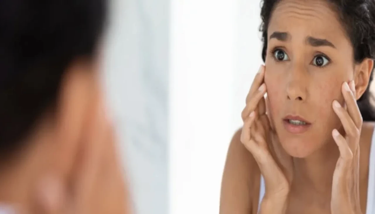 Hassas ciltler için hayat kurtaran liste! Dermatologlar tek tek anlattı