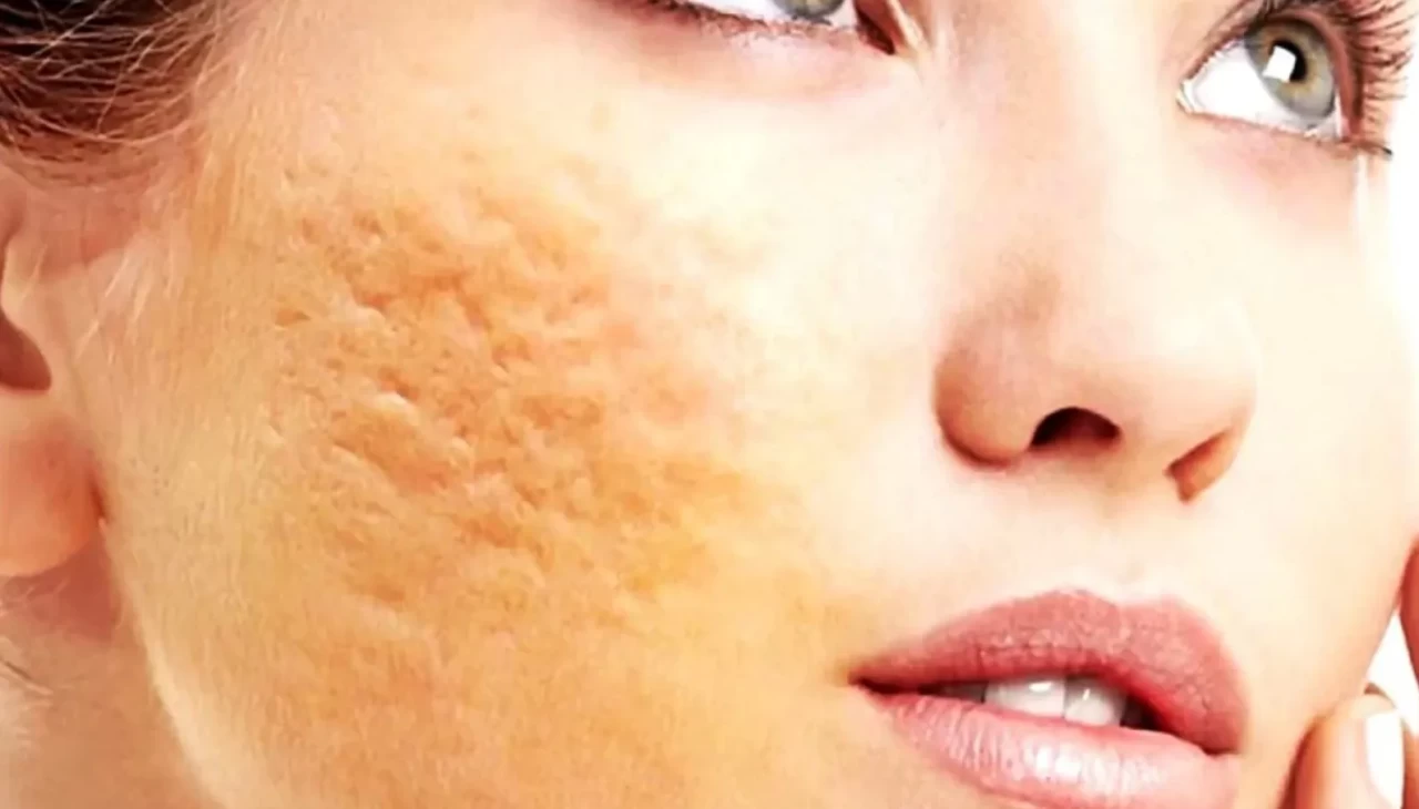 Aynadaki pürüzlü görüntüye son! 10 etkili maske tarifi tek listede toplandı