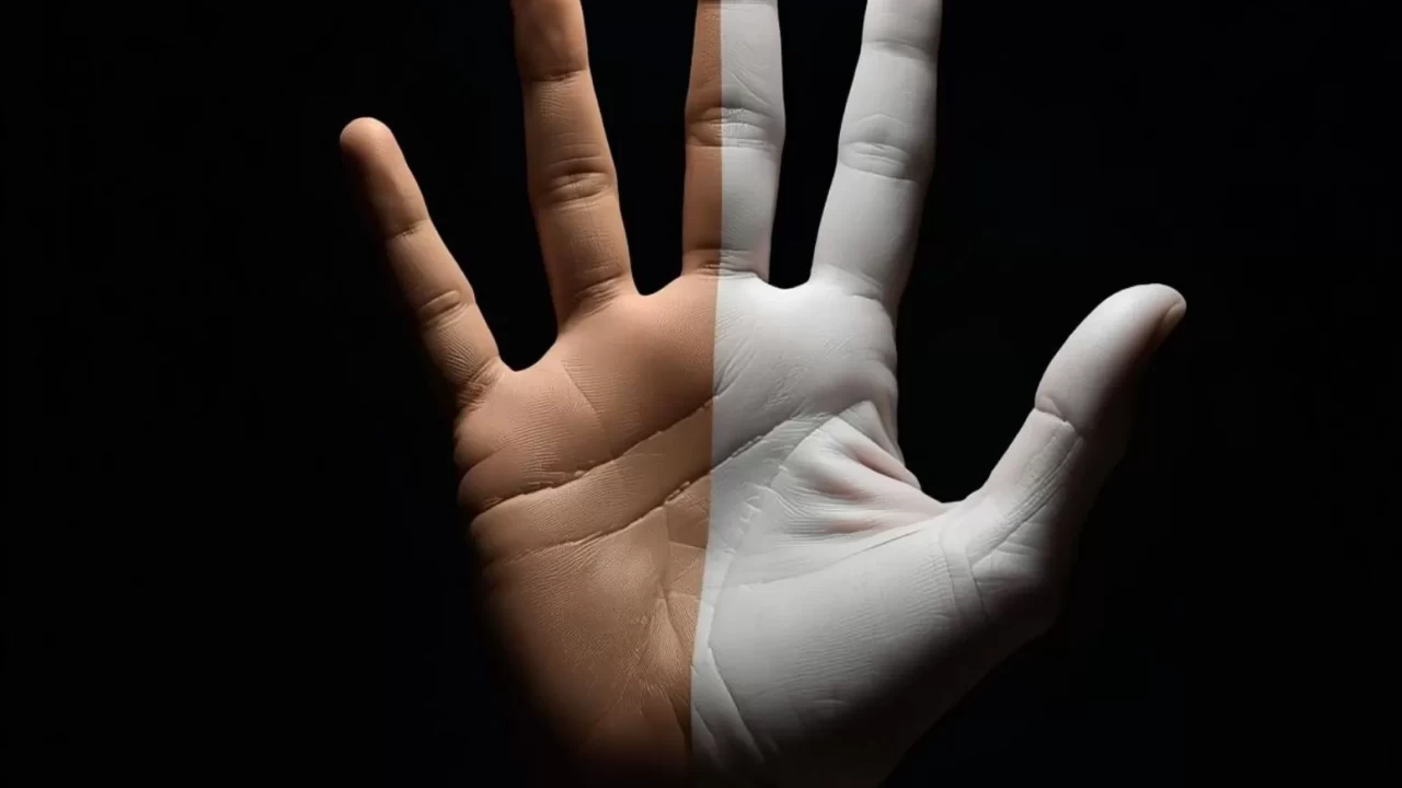 El ve ayak parmaklarınız morarıyorsa dikkat! Soğuk havalarda ortaya çıkan Raynaud tehlikesi