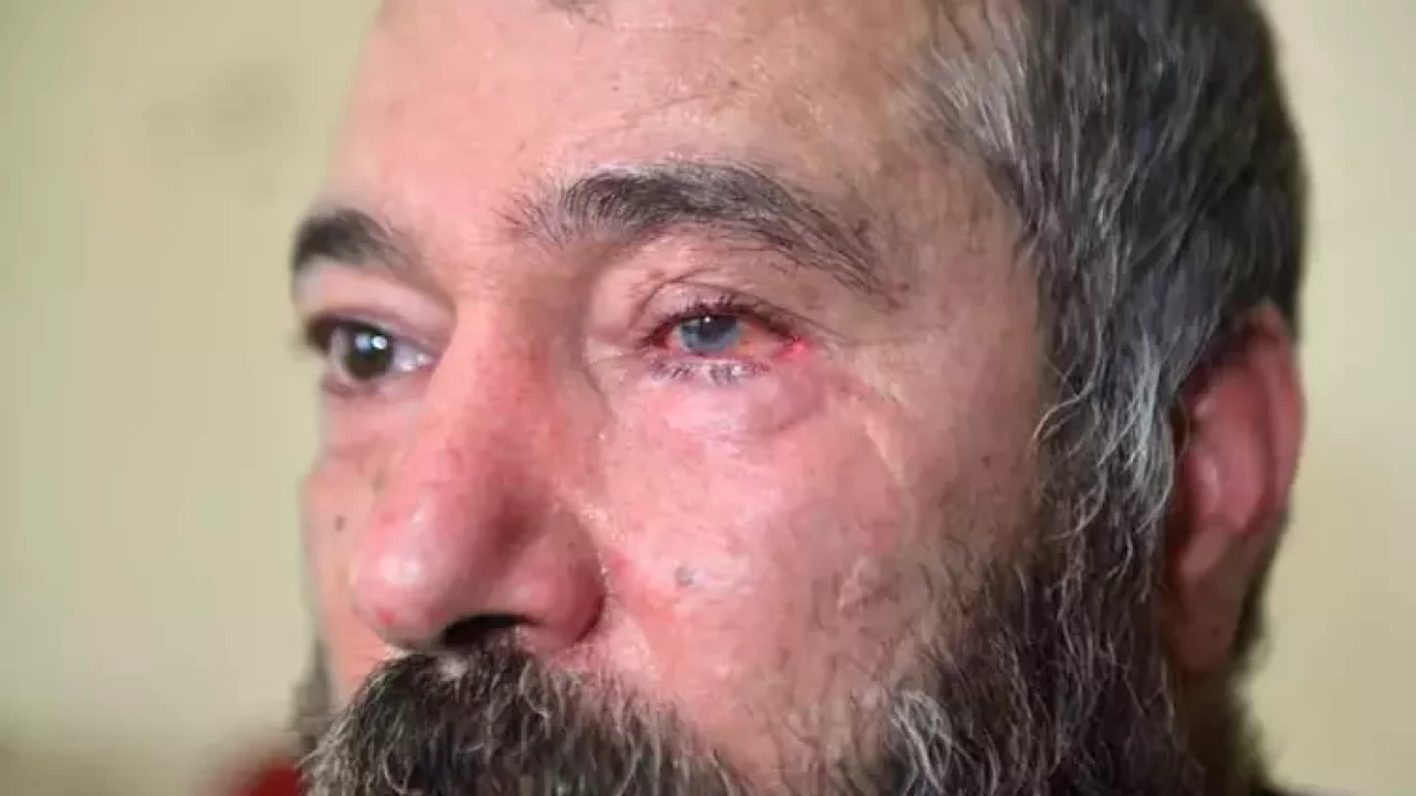 Adana’da durakta dehşet: Çay bardağıyla vurulan dolmuş şoförü gözünü kaybetti