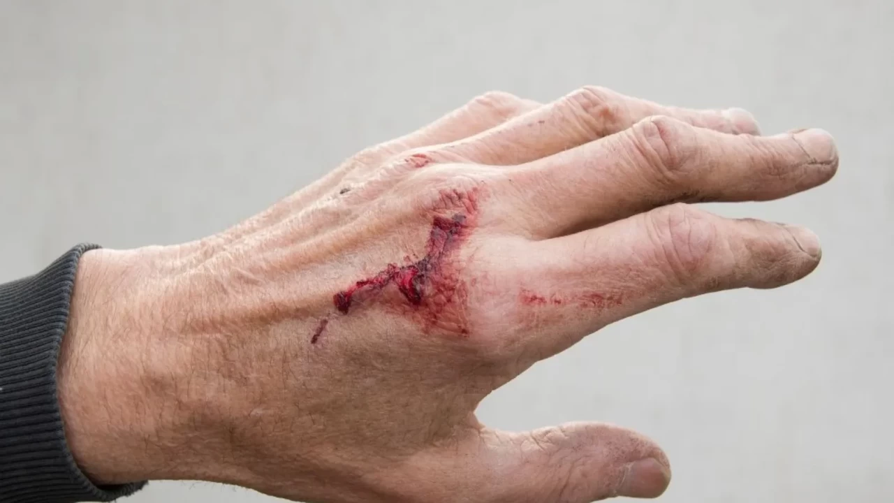 Yara ve çiziklere iyi gelen doğal krem!