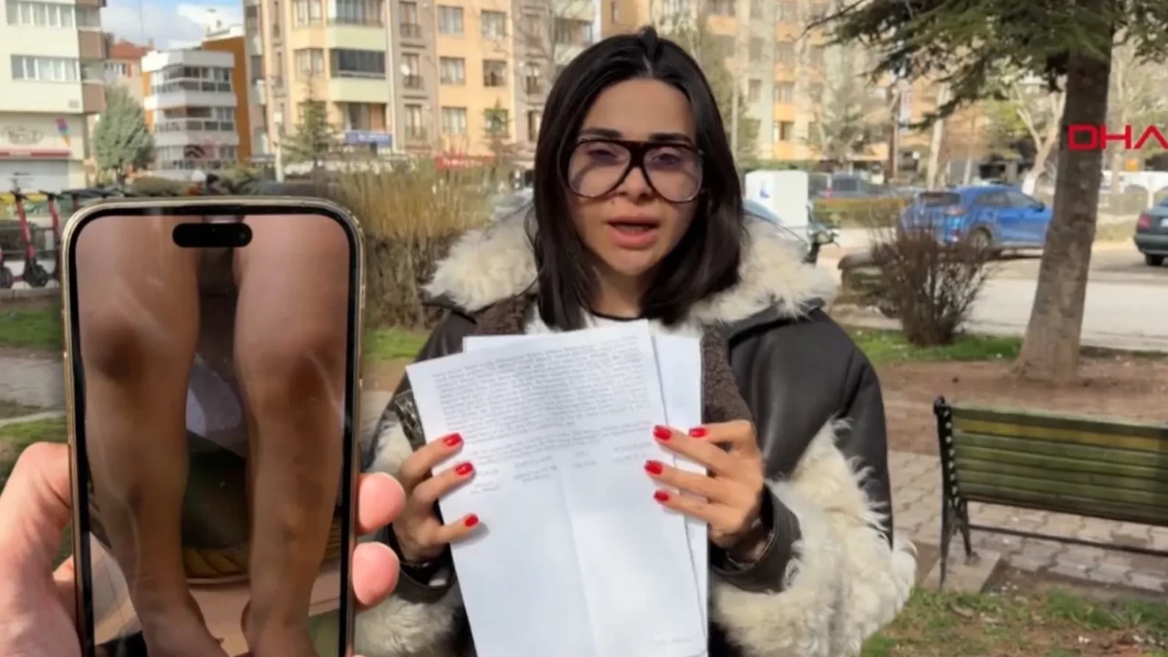 Eskişehir’de Kreşte Dayak İddiası Son Durum Nedir? Atlas Özdağ’ın Annesinden Suç Duyurusu: Soruşturma Başlatıldı