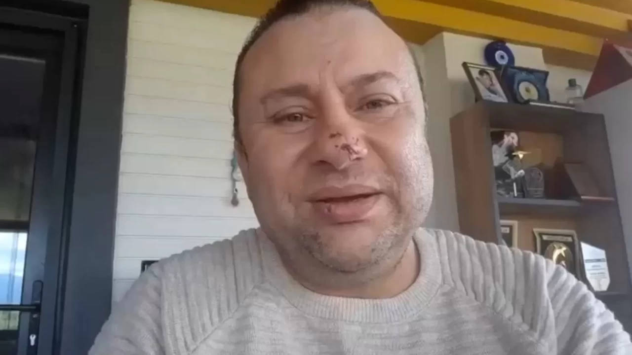 Onur Akay’ın Sağlık Durumu Nasıl? Nekrotizan Fasiite Hastalığı Belirtileri Nelerdir? Pitbull Saldırısında Son Dakika Gelişmesi