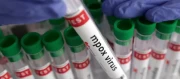 İngiltere’de Mpox alarmı verildi